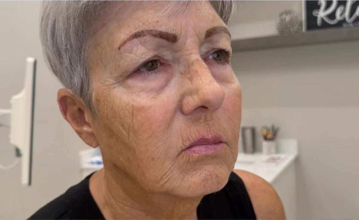 Client's face before treatment